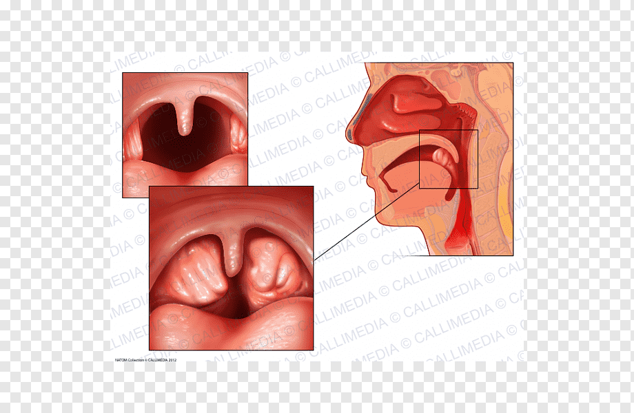 amigdala, adenoide